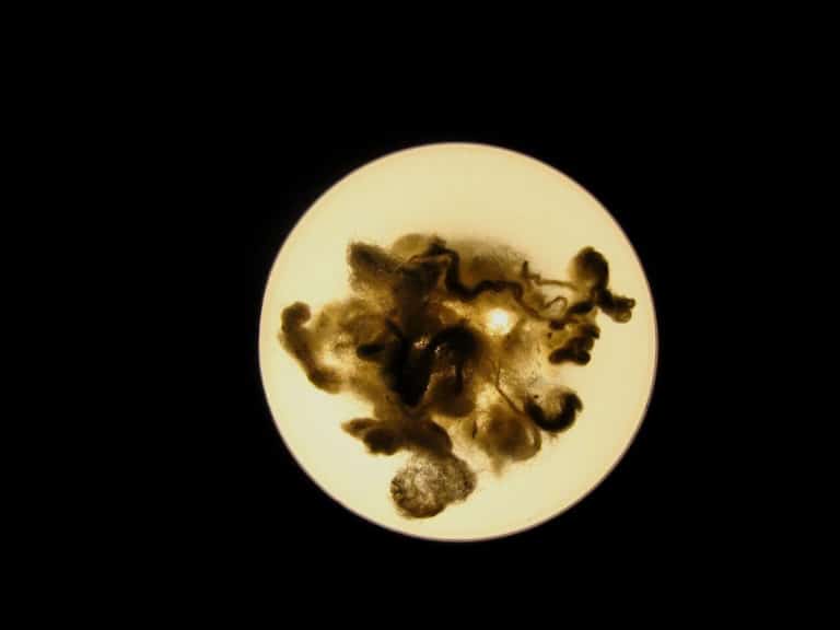 Umbilicus (Umbilicus)